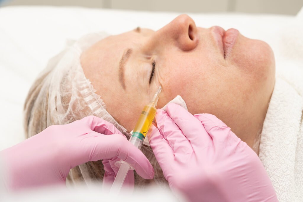 Cosmetologist makes prp therapy against wrinkles around the eyes and skin